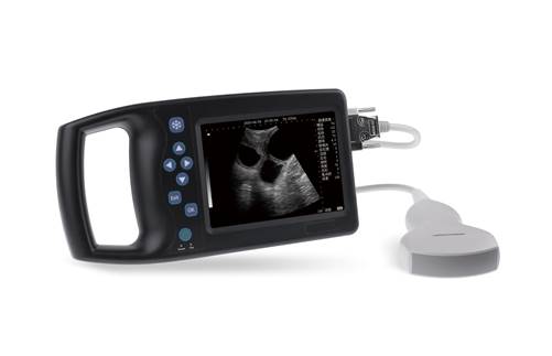掌上B超A6